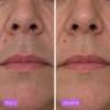 CyperGlow Cyperus Rotundus Skin Serum