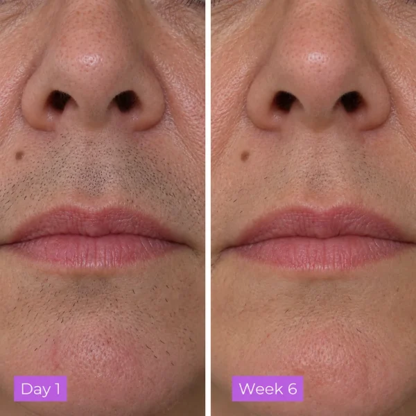 CyperGlow Cyperus Rotundus Skin Serum